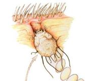 саркоптоз собак